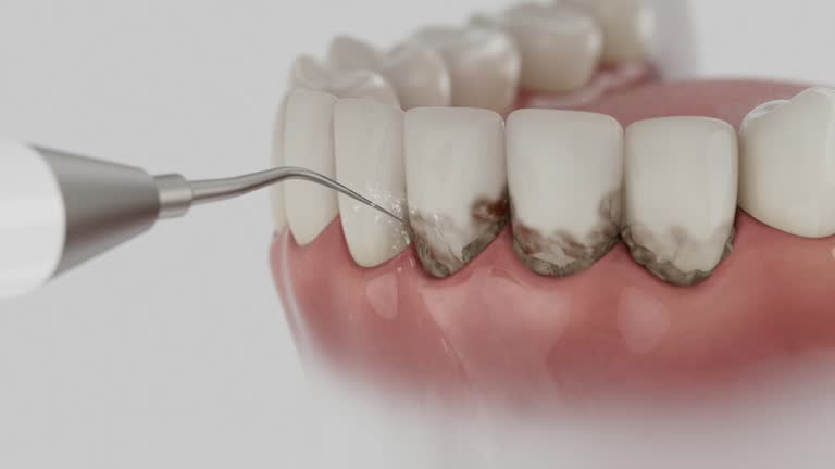 Trusted Teeth Cleaning And Checkup service in Hancock, MD - Dentist Open Now